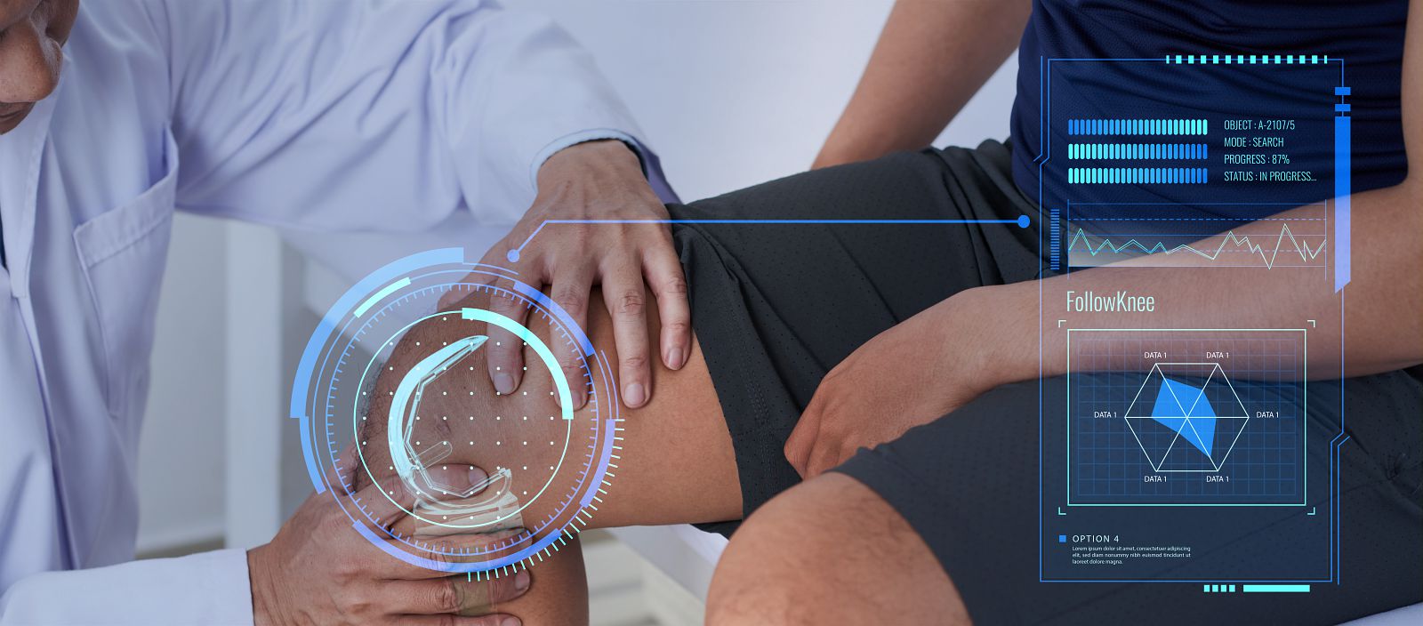 CES 2022: CEA-Leti to Unveil World’s-First Multi-Sensor System For Knee-Implants That Improves Surgery Accuracy, Detects Infection Early and Enhances Rehabilitation
